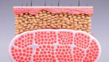 Fat image 2