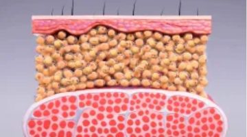 fat image 1